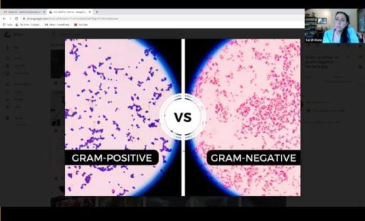 Two Plasma cells compared