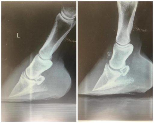 Left and Right foot x-ray
